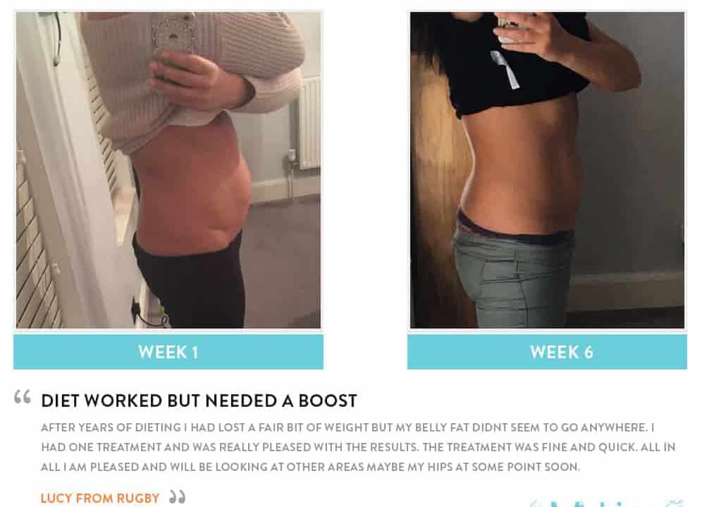 Before and After Dieting Hereford