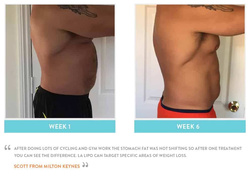 Before & After Stomach Fat Hereford