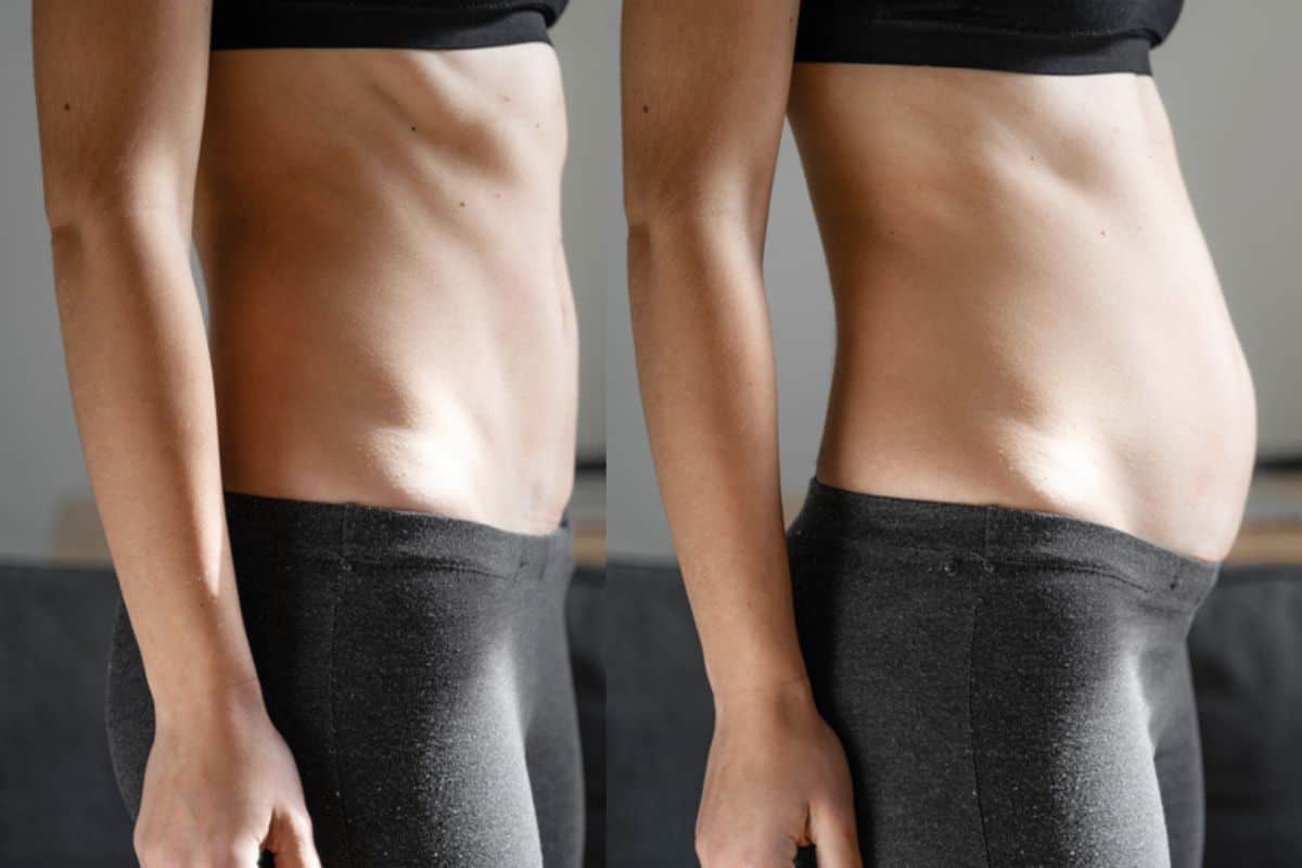 How long does diastasis recti take to improve Hereford?
