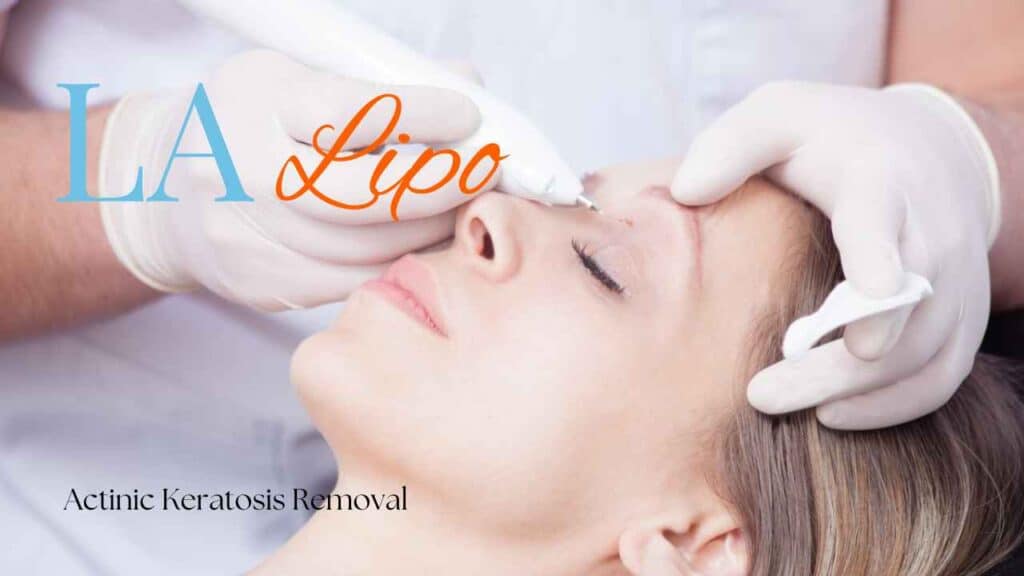 actinic keratosis removal Hereford