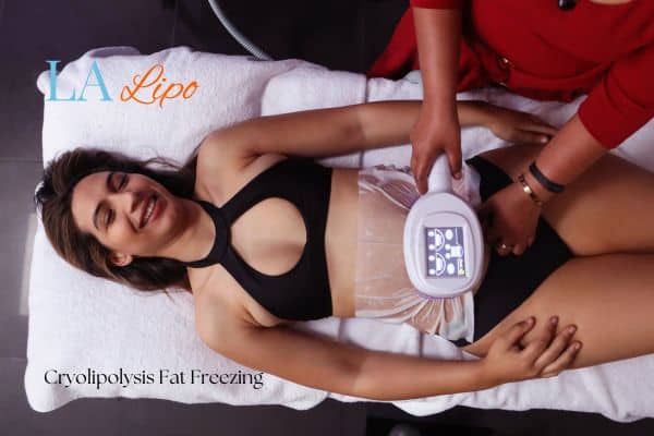 woman getting cryolipolysis Hereford