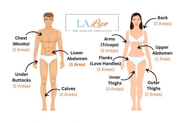 LA LIPO Cryolipolysis Areas Hereford
