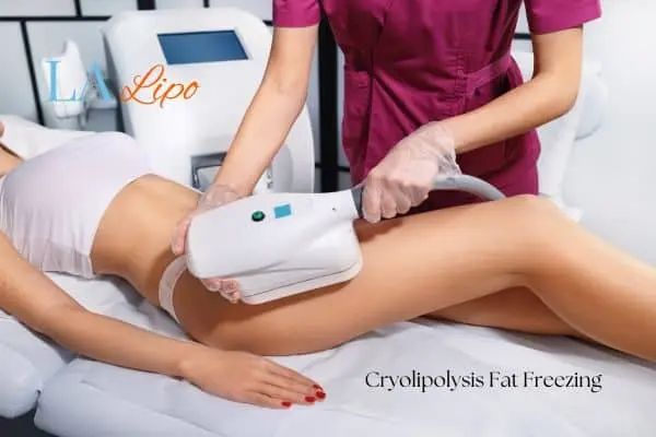 Woman receiving coolsculpting Hereford treatment on her thighs
