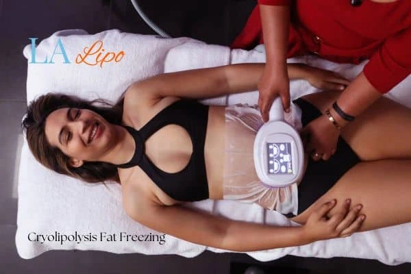 woman getting cryolipolysis Hereford