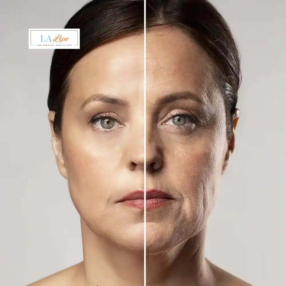 How Can You Tell If Non-Surgical Skin Tightening Is Right for You Hereford?